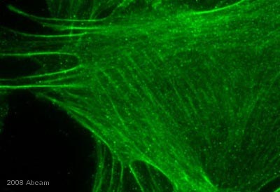 ab32519 staining mouse fibroblast cells by ICC/IF. Cells were PFA fixed, permeabilized in Triton X-100 and blocked in 1% BSA for 30 minutes at 25°C. The primary antibody was diluted 1/200 and incubated with sample for 4 hours at 25°C. An Alexa Fluor® 488 conjugated goat monoclonal to rabbit, diluted 1/500 was used as the secondary.See Abreview