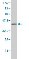 Western blot against tagged recombinant protein immunogen using ab55482 Myt1 antibody at 1ug/ml.