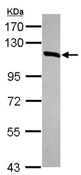 Anti-Hexokinase Type III antibody (ab126217) at 1/1000 dilution + Hela whole cell lysate at 30 µg