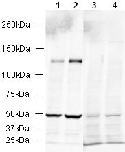 All lanes : Anti-N Cadherin antibody (ab18203) at 1 µg/mlLane 1 : Rat Brain LysateLane 2 : Mouse Brain Lysate Lane 3 : Rat Brain Lysate with Human N Cadherin peptide (ab18620) at 1 µg/mlLane 4 : Mouse Brain Lysate with Human N Cadherin peptide (ab18620) at 1 µg/mlLysates/proteins at 20 µg per lane.SecondaryAlexa Fluor Goat polyclonal to Rabbit IgG (700) at 1/10000 dilutionPerformed under reducing conditions.