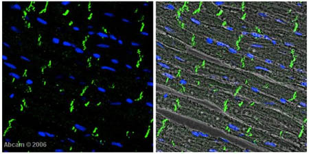  ab12221 at 1/200 dilution staining rat heart tissue sections by IHC-P. The tissue was fixed with Histochoice and paraffin sectioned prior to staining. An Alexa-Fluor conjugated donkey anti-rabbit antibody was used as the secondary. The image depicts stained N-Cadherin (green) and counterstained nuclei (DAPI-blue) overlay (left panel). The DIC (phase) image of the same tissue, superimposed with fluorescence overlay (right panel) confirms the localization of the N-Cadherin at intercalated discs region. Note, the phase contrast image shows typical uninucleated, cylindrical morphology of cardiac myocytes; that are often branched and joined to each other end-to-end (intercalated discs) to form interlacing network.See Abreview