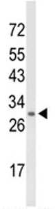 Anti-N myc interactor antibody (ab102769) at 1/100 dilution + HeLa cell line lysate at 35 µg