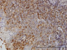 N myc interactor antibody (ab56434) used in immunohistochemistry at 3ug/ml on formalin fixed and paraffin embedded human tonsil.
