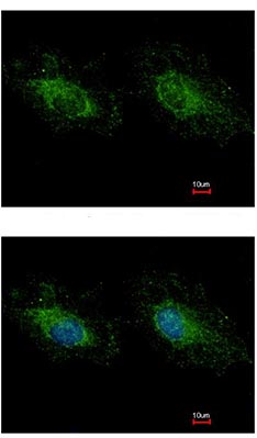ab126217, at 1/500 dilution, staining Hexokinase Type III in methanol fixed Hela cells by Immunofluorescence. The image in the lower panel was costained with Hoechst 33342.