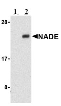 All lanes : Anti-NADE antibody (ab21303) at 1 µg/mlLane 1 : human brain cell lysate with blocking peptide.Lane 2 : human brain cell lysate with Without blocking peptide.