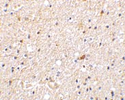 ab21303 at 2µg/ml staining NADE in human brain tissue by IHC