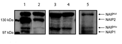 All lanes : Anti-NAIP antibody (ab2549) at 1/1000 dilutionLane 1 : Lysate prepared from transfected PC3 cells.Lane 2 : Lysate prepared from non-transfected PC3 cells.Lane 3 : Lysate prepared from transfected HeLa cells.Lane 4 : Lysate prepared from non-transfected HeLa cells.Lane 5 : Lysate prepared from non-transfected NTera2D1 cells.Secondarysecondary antibody at 1/100000 dilutionObserved band size : 160 kDa (why is the actual band size different from the predicted?)Additional bands at : 105 kDa (possible isoform),115 kDa,130 kDa (possible isoform). We are unsure as to the identity of these extra bands.Image from Dr MT Romanish et al, PLoS One. 2009 Jun 2;4(6):e5761, Fig 5.