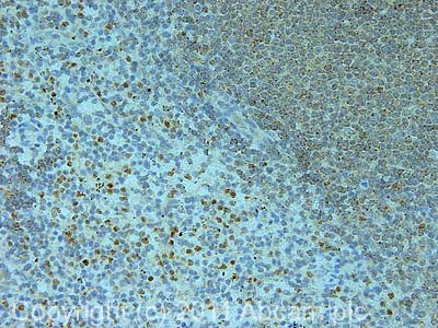 IHC image of ab36852 staining in human normal spleen formalin fixed paraffin embedded tissue section, performed on a Leica BondTM system using the standard protocol F. The section was pre-treated using heat mediated antigen retrieval with sodium citrate buffer (pH6, epitope retrieval solution 1) for 20 mins. The section was then incubated with ab36852, 5µg/ml, for 15 mins at room temperature and detected using an HRP conjugated compact polymer system. DAB was used as the chromogen. The section was then counterstained with haematoxylin and mounted with DPX.For other IHC staining systems (automated and non-automated) customers should optimize variable parameters such as antigen retrieval conditions, primary antibody concentration and antibody incubation times.