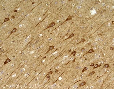 IHC image of NAPL1 staining in human cerebral cortex formalin fixed paraffin embedded tissue section, performed on a Leica Bond system using the standard protocol F. The section was pre-treated using heat mediated antigen retrieval with sodium citrate buffer (pH6, epitope retrieval solution 1) for 20 mins. The section was then incubated with ab98181, 1µg/ml, for 15 mins at room temperature and detected using an HRP conjugated compact polymer system. DAB was used as the chromogen. The section was then counterstained with haematoxylin and mounted with DPX.For other IHC staining systems (automated and non-automated) customers should optimize variable parameters such as antigen retrieval conditions, primary antibody concentration and antibody incubation times.