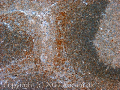 IHC image of NALP12 staining in Human normal tonsil formalin fixed paraffin embedded tissue section, performed on a Leica BondTM system using the standard protocol F. The section was pre-treated using heat mediated antigen retrieval with EDTA buffer (pH9, epitope retrieval solution 2) for 20 mins. The section was then incubated with ab100863, 10µg/ml, for 15 mins at room temperature and detected using an HRP conjugated compact polymer system. DAB was used as the chromogen. The section was then counterstained with haematoxylin and mounted with DPX.For other IHC staining systems (automated and non-automated) customers should optimize variable parameters such as antigen retrieval conditions, primary antibody concentration and antibody incubation times.
