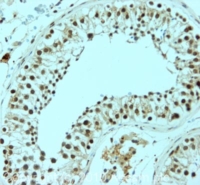 IHC image of Nanog staining in human normal testis formalin fixed paraffin embedded tissue section, performed on a Leica BondTM system using the standard protocol F. The section was pre-treated using heat mediated antigen retrieval with sodium citrate buffer (pH6, epitope retrieval solution 1) for 20 mins. The section was then incubated with ab93240, 5µg/ml, for 15 mins at room temperature and detected using an HRP conjugated compact polymer system. DAB was used as the chromogen. The section was then counterstained with haematoxylin and mounted with DPX