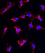 ab65203 at 1/50 dilution staining Nanos Homologue 1 in human Hela cells by Immunocytochemistry /Immunofluorescence. An Alexa-Fluor 546 conjugated donkey polyclonal to rabbit IgG was used as secondary.