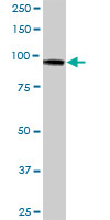 Anti-Hexokinase Type III antibody (ab90570) at 1 µg/ml + Human spleen tissue lysate at 50 µg