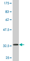 Anti-NAT14 antibody (ab76846) at 5 µg/ml + immunogen at 0.2 µgSecondaryGoat Anti-Mouse IgG (H&L)-HRP Conjugate at 1/5000 dilution