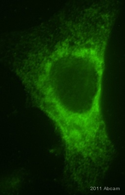 ab76842 staining FLJ37478 in CHO cells transfected with mouse Nat8l cDNA by Immunocytochemistry/ Immunoflourescence. Cells were PFA-fixed and permeabilized in 0.3% Triton X-100 prior to blocking in 1% BSA for 30 minutes at 25°C. The primary antibody was diluted 1/150 in 1% BSA in PBS and incubated with the sample for 1 hour at 25°C. The secondary antibody was Cy2®-conjugated Goat- anti-Rabbit polyclonal, diluted 1/200.See Abreview