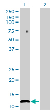 All lanes : Anti-NAT8L antibody (ab69464) at 1/500 dilutionLane 1 : FLJ37478 transfected 293T cell lysateLane 2 : Non transfected 293T cell lysateLysates/proteins at 25 µg per lane.SecondaryGoat Anti-Mouse IgG (H&L)-HRP Conjugate at 1/2500 dilution