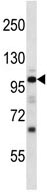 Anti-Natriuretic Peptide Receptor A antibody (ab116680) at 1/1000 dilution + Mouse heart tissue lysate at 35 µgSecondaryPeroxidase-conjugated goat anti-rabbit IgG (H+L) at 1/5000 dilution