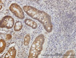 Natriuretic Peptide Receptor B antibody (ab55718) used in immunohistochemistry at 3ug/ml on formalin fixed and paraffin embedded human stomach.