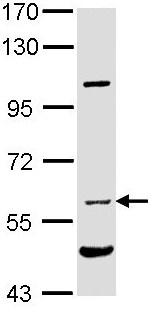 Anti-Natriuretic Peptide Receptor C antibody (ab97389) at 1/10000 dilution + HepG2 whole cell lysate at 30 µg