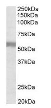 Anti-Natriuretic Peptide Receptor C antibody (ab126841) at 1 µg/ml + Human Placenta lysate in RIPA buffer for 1 hour at 35 µgdeveloped using the ECL technique