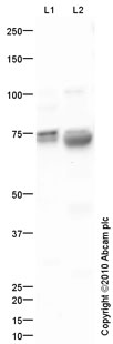 All lanes : Anti-Natriuretic Peptide Receptor C antibody (ab79164) at 1 µg/mlLane 1 : Heart (Human) Tissue Lysate - adult normal tissue (ab29431)Lane 2 : Blood Vessel: artery (Human) Membrane Lysate - adult normal tissue (ab28989)Lysates/proteins at 10 µg per lane.SecondaryGoat polyclonal to Rabbit IgG - H&L - Pre-Adsorbed (HRP) at 1/3000 dilutiondeveloped using the ECL techniquePerformed under reducing conditions.