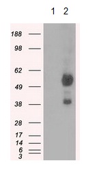 All lanes : Anti-Natriuretic Peptide Receptor C antibody [11H6] (ab123957) at 1/2000 dilutionLane 1 : HEK293T cells transfected with pCMV6-ENTRY control cDNALane 2 : HEK293T cells transfected with pCMV6-ENTRY Natriuretic Peptide Receptor C cDNALysates/proteins at 5 µg per lane.