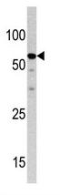 Anti-NCAPH2 antibody (ab71459) at 1/60 dilution + HepG2 cell line lysate at 12.5 µgObserved band size : 62 kDa (why is the actual band size different from the predicted?)
