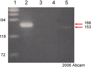 ab17984 in ChIP of rabbit endometrium nuclear cell lysate. In vivo binding of SMARCA3 (RUSH) to DNA and Egr-1/c-Rel in the rabbit RUSH promoter was confirmed by PCR amplification of products from ChIP assays. Lane 1 FX174/HaeIII size markers. Lane 2 Single 166-bp amplicons of the SMARCA3 (RUSH) site resulting from ChIP with antibodies to SMARCA3. Lanes 3 Negative ChIP control (IgG) Lane 4 PCR control (water)Lane 5 Single 153-bp amplicons of the Sp1(A) site resulting from ChIP with antibodies to SMARCA3. The SMARCA3 (RUSH) site was identified through antibody-SMARCA3-DNA binding. The Sp1(A) site is an Egr-1/Sp1/3/MAZ/MZF1/c-Rel composite binding site that was identified through antibody-SMARCA3-Egr-1/c-Rel-DNA binding. Cross-linking agent: disuccinimydyl glutarate and formaldehyde (0.75%)See Abreview