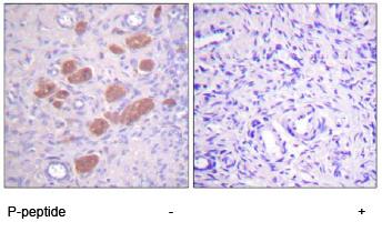 ab59355, at a 1/50 dilution, staining human NCF4 in ovary, using Immunohistochemistry, Paraffin embedded tissue, in the absence of the immunizing peptide (left image) and in the presence of the immunizing peptide (right image).