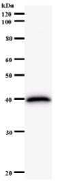 Anti-NCKIPSD antibody [2614C1a] (ab58676)
