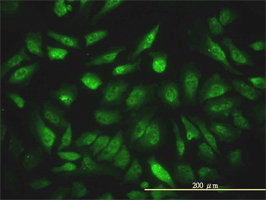 NCOA4 antibody (ab56356) used in immunofluorescence at 10ug/ml on HeLa cells.