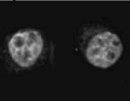 Immunolocalization of SMRT in HeLa cells using ab2780.