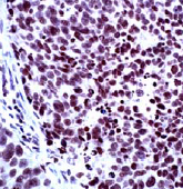 Staining of human brain using ab27541