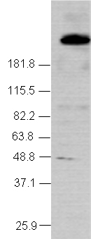 Anti-NCOR2 antibody - ChIP Grade (ab24551) at 1/1000 dilution + HeLa nuclear extract