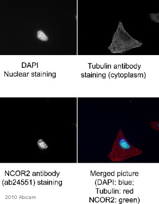 ab24551 staining NCOR2 (green) in Human Hela cells by ICC/IF (Immunocytochemistry/immunofluorescence). Cells were fixed with methanol and blocked with 0.2% fish scale gelatin for 1 hour at 25°C. Samples were incubated with primary antibody (1/300 in PBS + 0.2% fish scale gelatin) for 20 minutes at 25°C. An Alexa Fluor®488-conjugated Donkey anti-rabbit IgG polyclonal (1/500) was used as the secondary antibody.See Abreview
