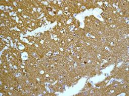 ab129165, at 1/250 dilution staining NCS1 in paraffin-embedded Human brain tissue, by Immunohistochemistry.