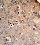 Immunohistochemical analysis of formalin-fixed, paraffin-embedded mouse brain tissue labelling NCX1 with ab135735 at 1/50 dilution, followed by peroxidase conjugated secondary antibody and DAB staining.