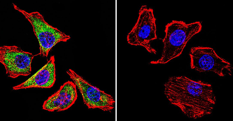 Immunocytochemistry/Immunofluorescence analysis of NCX1 shows staining in U251 cells. NCX1 staining (green), F-Actin staining with Phalloidin (red) and nuclei with DAPI (blue) is shown. Cells were grown on chamber slides and fixed with formaldehyde prior to staining. Cells were incubated without (control) or with ab2869 (1:100) overnight at 4°C, washed with PBS and incubated with a DyLight-488 conjugated goat anti-mouse secondary antibody. Images were taken at 60X magnification.