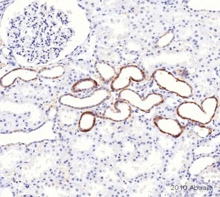 ab2869 staining NCX1 in Human kidney tissue sections by Immunohistochemistry (IHC-P - formaldehyde-fixed, paraffin-embedded sections). Tissue was fixed with formaldehyde, permeabilized with 0.05% Tween20 and blocked with 5% normal goat serum in 1XPBS + 0.05% Tween20 for 1 hour at 25°C; antigen retrieval was by heat mediation in sodium citrate (pH 6.0) buffer. Samples were incubated with primary antibody (1/100 in blocking buffer) for 1 hour at 25°C. Ab47827 (1/500) was used as the secondary antibody.See Abreview