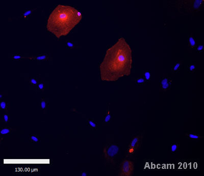 This image shows Human embryonic stem cell derived cardiomyocytes, stained with dapi (blue) and anti-NCX1 antibody ab2869 (red). The cells were fixed in paraformaldehyde, permeabilized with 0.1% Triton X-100 in PBS and blocked with 4% goat serum for 1 hour. The cells were then incubated with primary antibody (1/100) for 16 hours at 4°C.See Abreview