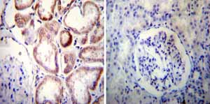 Immunohistochemistry was performed on both normal and cancer biopsies of deparaffinized Human kidney tissue tissues. To expose target proteins heat induced antigen retrieval was performed using 10mM sodium citrate (pH6.0) buffer microwaved for 8-15 minutes. Following antigen retrieval tissues were blocked in 3% BSA-PBS for 30 minutes at room temperature. Tissues were then probed at a dilution of 1:50 with a mouse monoclonal antibody recognizing Sodium/Calcium Exchanger ab2869 or without primary antibody (negative control) overnight at 4°C in a humidified chamber. Tissues were washed extensively with PBST and endogenous peroxidase activity was quenched with a peroxidase suppressor. Detection was performed using a biotin-conjugated secondary antibody and SA-HRP followed by colorimetric detection using DAB. Tissues were counterstained with hematoxylin and prepped for mounting.