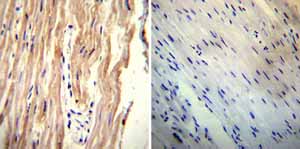 Immunohistochemistry was performed on both normal and cancer biopsies of deparaffinized Human heart tissue tissues. To expose target proteins heat induced antigen retrieval was performed using 10mM sodium citrate (pH6.0) buffer microwaved for 8-15 minutes. Following antigen retrieval tissues were blocked in 3% BSA-PBS for 30 minutes at room temperature. Tissues were then probed at a dilution of 1:20 with a mouse monoclonal antibody recognizing Sodium/Calcium Exchanger ab2869 or without primary antibody (negative control) overnight at 4°C in a humidified chamber. Tissues were washed extensively with PBST and endogenous peroxidase activity was quenched with a peroxidase suppressor. Detection was performed using a biotin-conjugated secondary antibody and SA-HRP followed by colorimetric detection using DAB. Tissues were counterstained with hematoxylin and prepped for mounting.