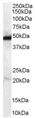 Anti-NDRG1 antibody (ab37897) at 0.1 µg/ml + Human Kidney lysate (RIPA buffer, 35µg total protein per lane).