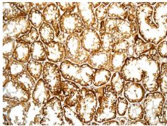 Immunohistochemical analysis of paraffin embedded Human kidney tissue labelling NDRG3 with ab131266 at 1/250 dilution.