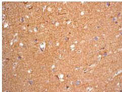 Immunohistochemical analysis of paraffin embedded Human brain tissue labelling NDRG3 with ab131266 at 1/250 dilution.