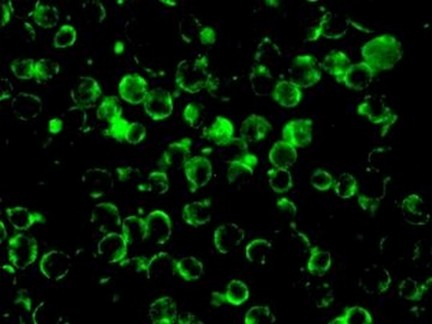 Immunofluorescent staining of Raji cells labelling NDRG3 with ab133715 at 1/100.