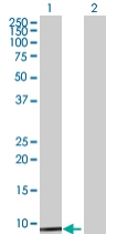 All lanes : Anti-NDUFA3 antibody (ab68089) at 1/500 dilutionLane 1 : NDUFA3 transfected 293T cell lysateLane 2 : non transfected 293T cell lysateLysates/proteins at 25 µg per lane.SecondaryGoat Anti-Mouse IgG (H&L)-HRP Conjugate at 1/2500 dilution