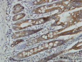 NDUFA9 antibody (ab55521) used in immunohistochemistry at 8ug/ml on formalin fixed and paraffin embedded human small Intestine.