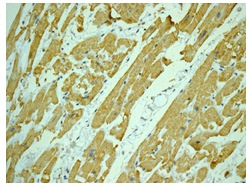 Immunohistochemical analysis of paraffin embedded Human heart tissue labeling NDUFA9 with ab181381 at 1/50 dilution.