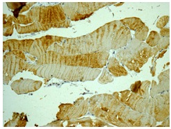 Immunohistochemical analysis of paraffin embedded Human skeletal muscle tissue labeling NDUFA9 with ab181381 at 1/50 dilution.